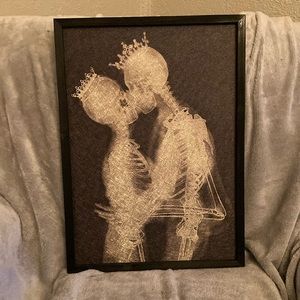 King and Queen Skeletons X-Ray Home Decor